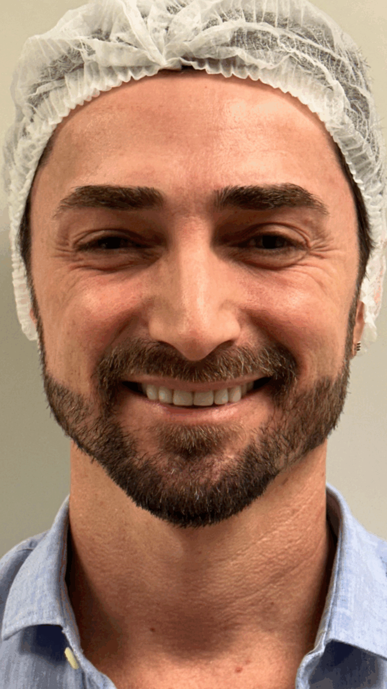 BLEFAROPEEL Resultados.zip - 7