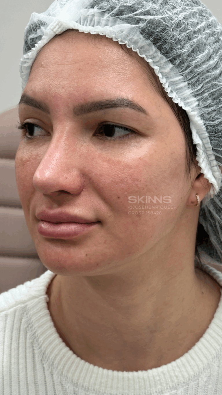 SKIMS GLOW Resultados - 1