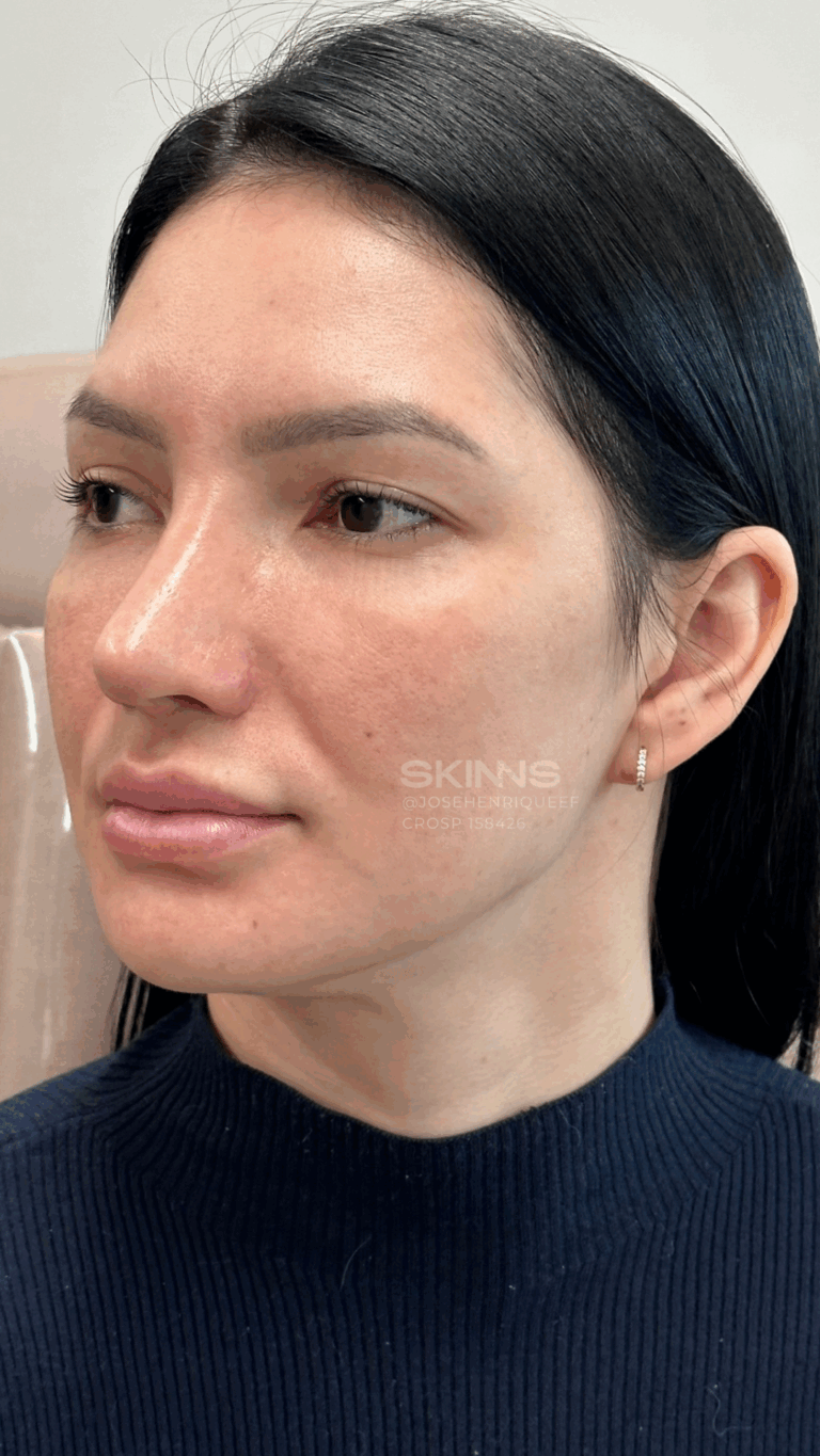 SKIMS GLOW Resultados - 2