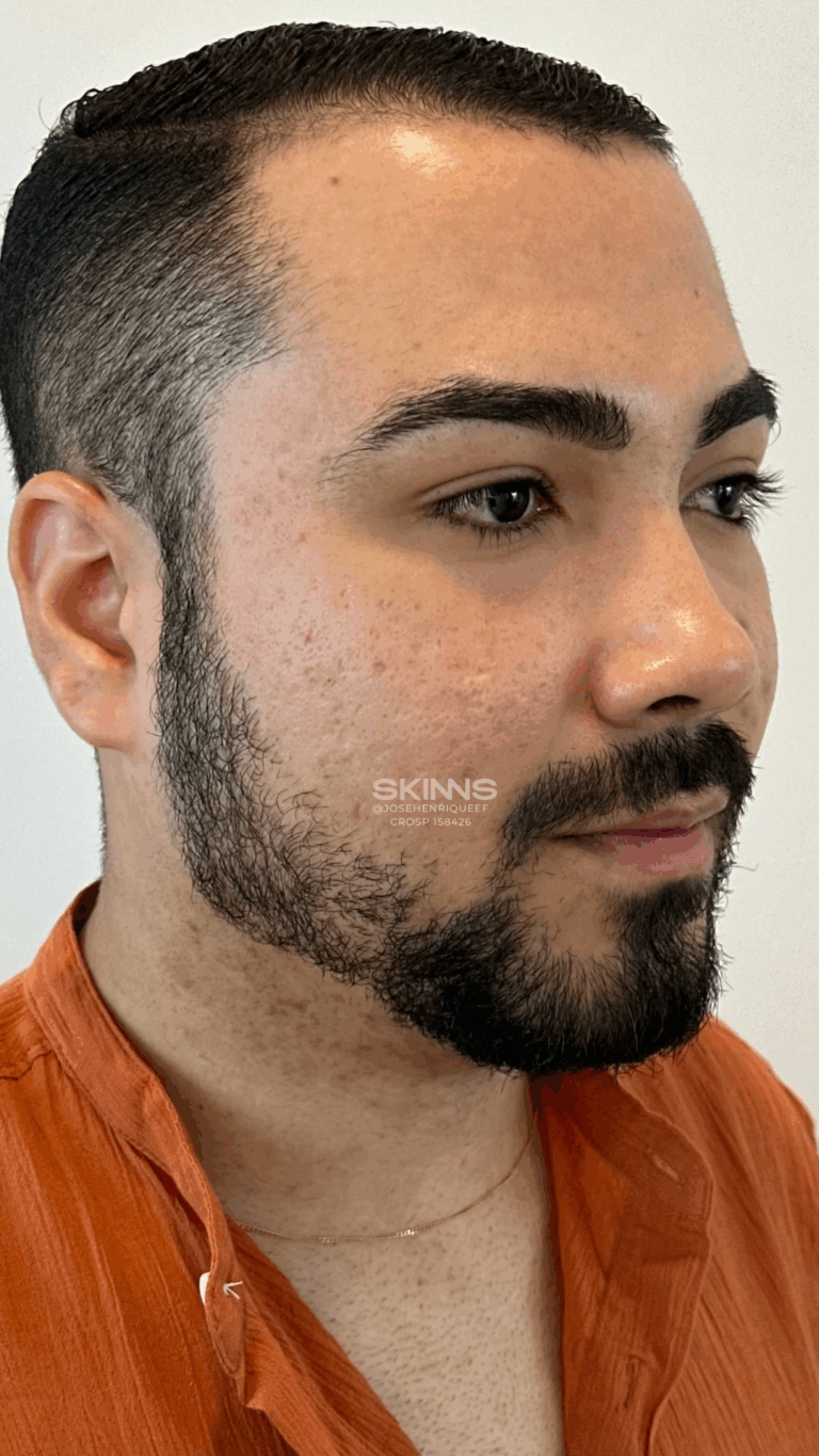 SKIMS POINT Resultados - 5