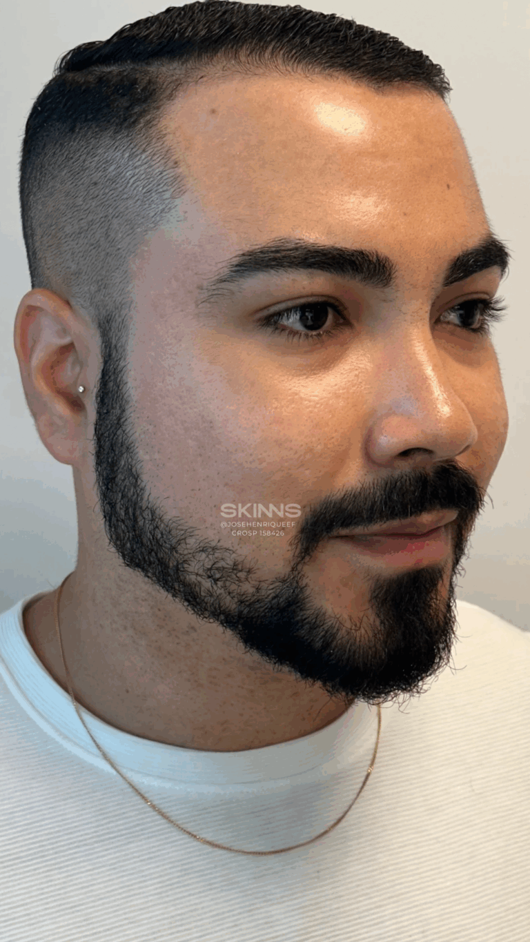 SKIMS POINT Resultados - 6