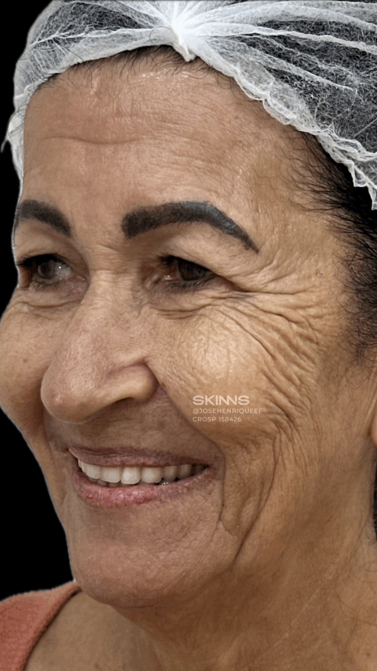 SKIMS Rejuvenescimento Resultados.zip - 1