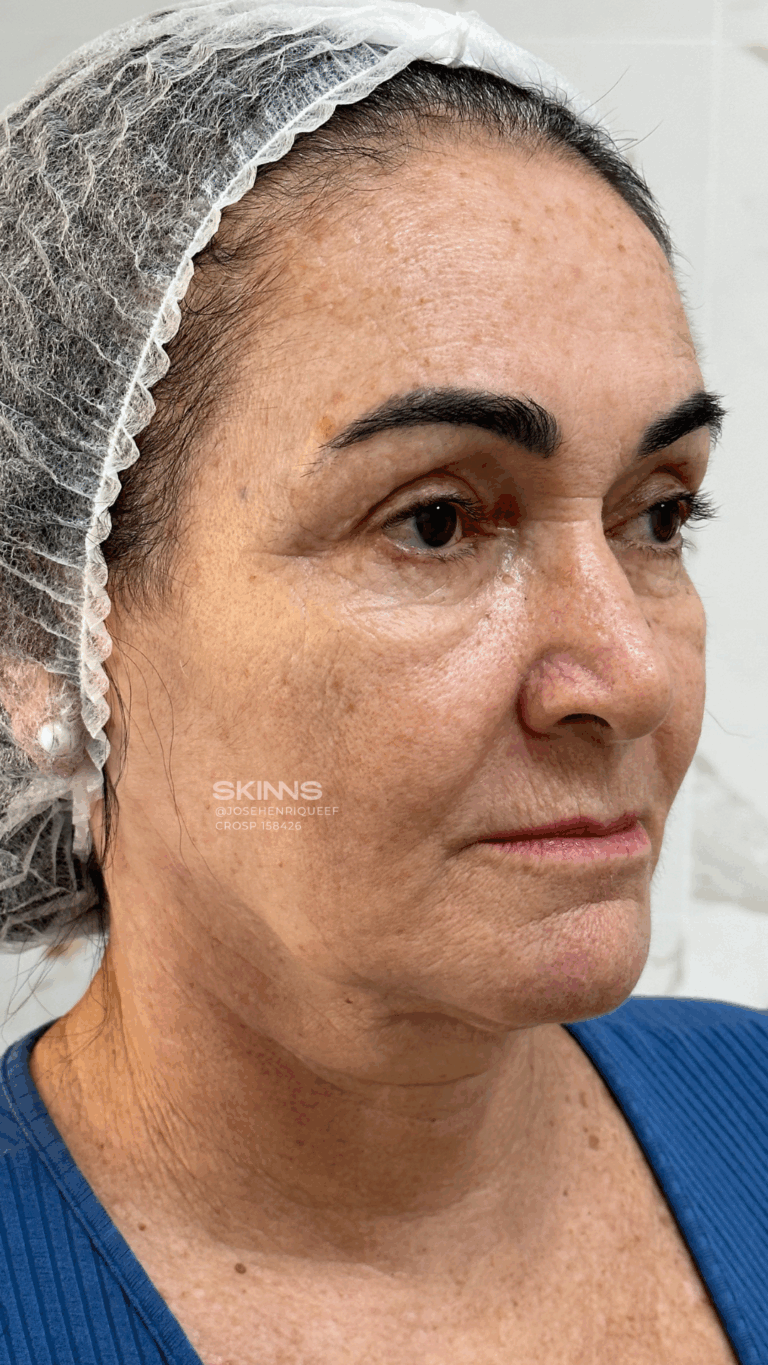 SKIMS Rejuvenescimento Resultados.zip - 10