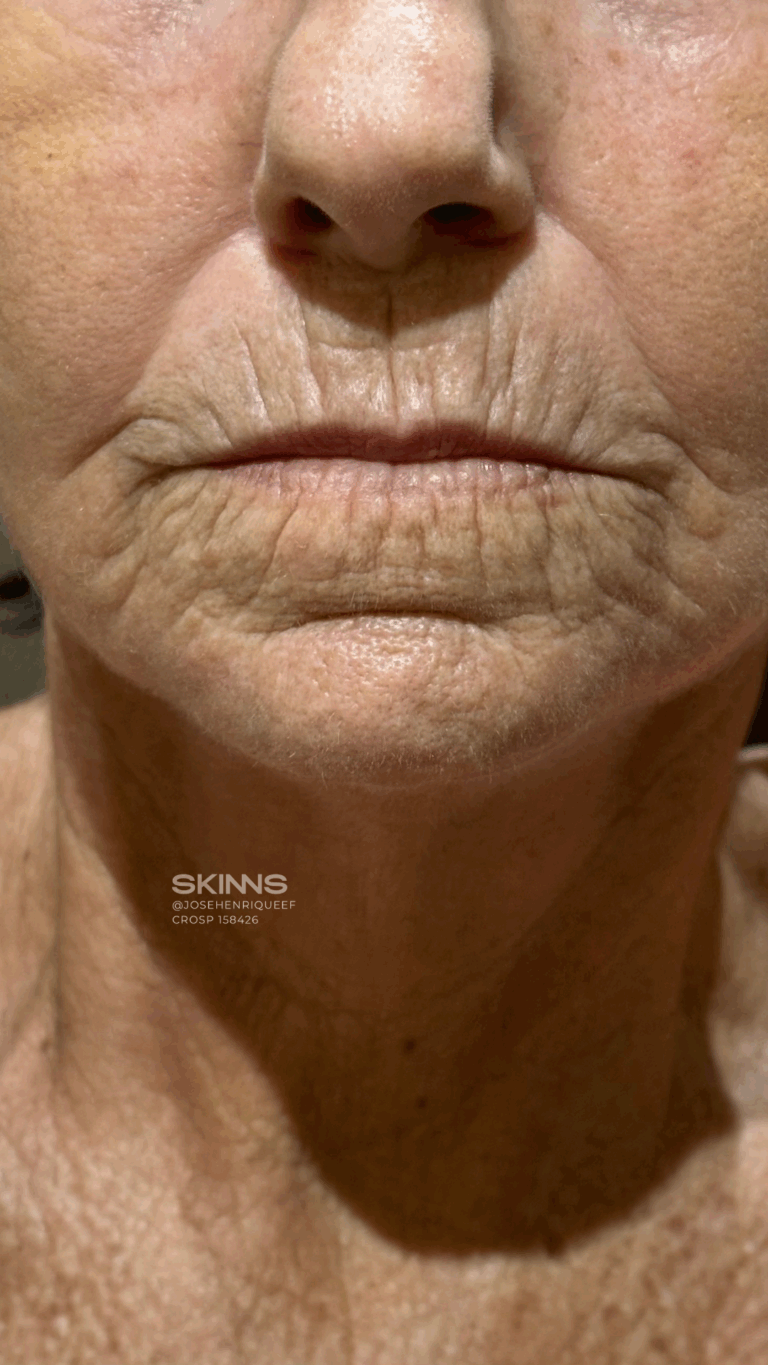 SKIMS Rejuvenescimento Resultados.zip - 12