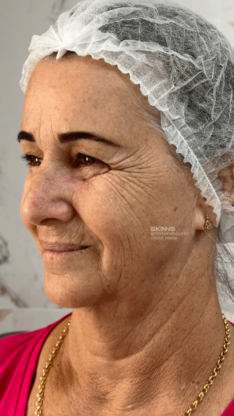 SKIMS Rejuvenescimento Resultados.zip - 16