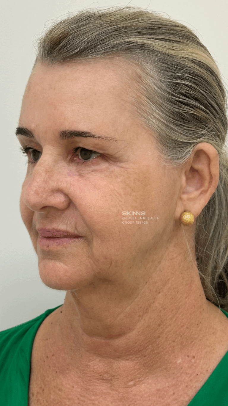 SKIMS Rejuvenescimento Resultados.zip - 17