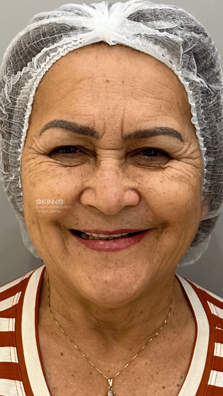 SKIMS Rejuvenescimento Resultados.zip - 18