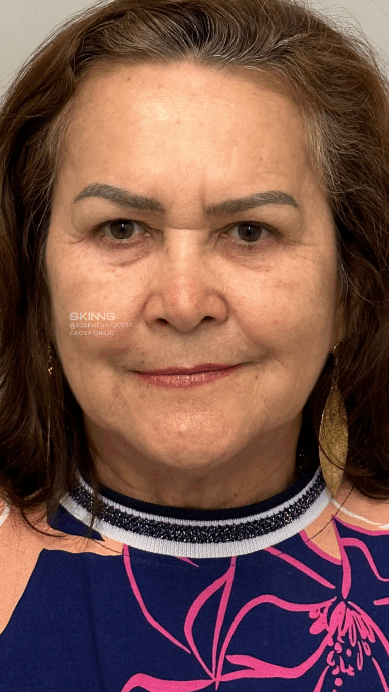 SKIMS Rejuvenescimento Resultados.zip - 19