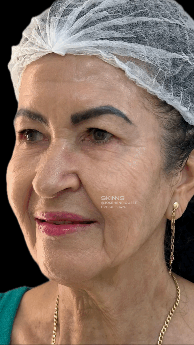 SKIMS Rejuvenescimento Resultados.zip - 2