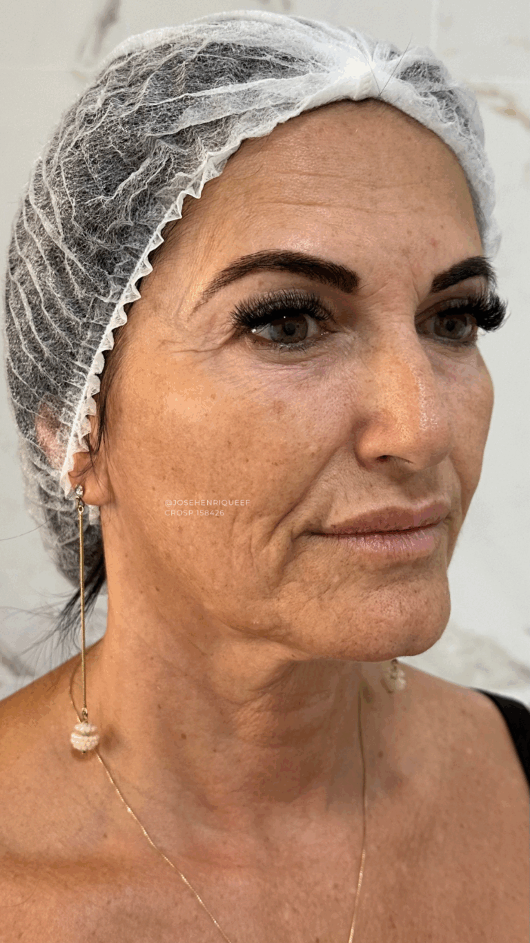 SKIMS Rejuvenescimento Resultados.zip - 20