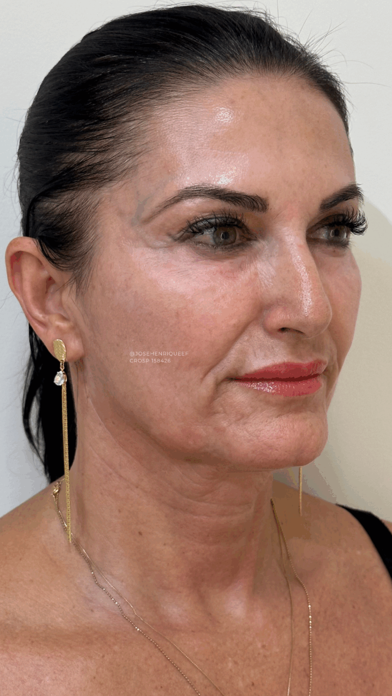 SKIMS Rejuvenescimento Resultados.zip - 21