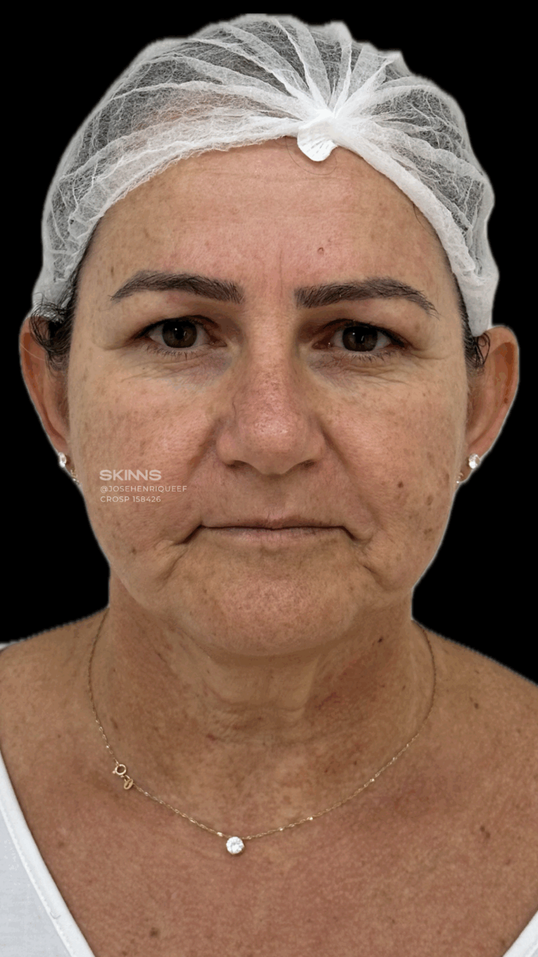 SKIMS Rejuvenescimento Resultados.zip - 22