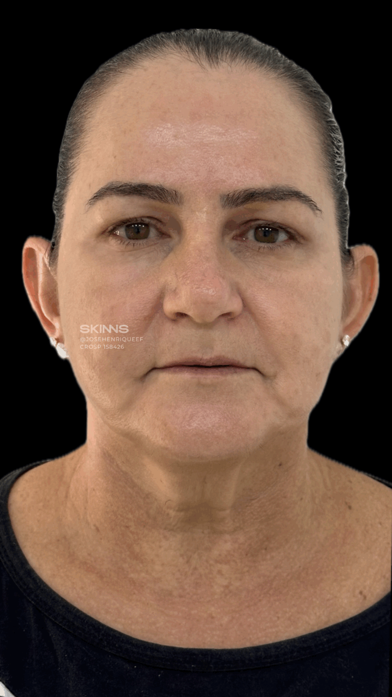 SKIMS Rejuvenescimento Resultados.zip - 23