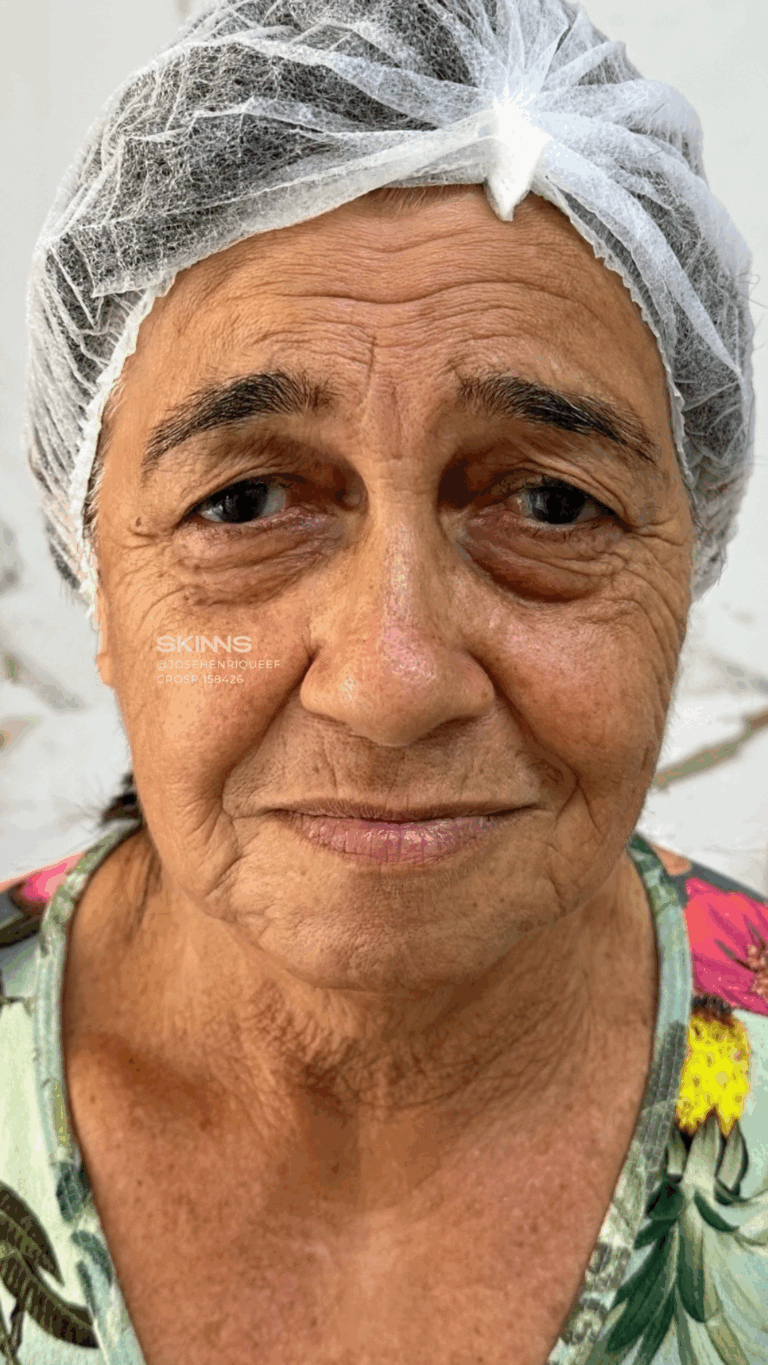 SKIMS Rejuvenescimento Resultados.zip - 24