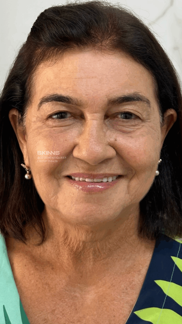 SKIMS Rejuvenescimento Resultados.zip - 25