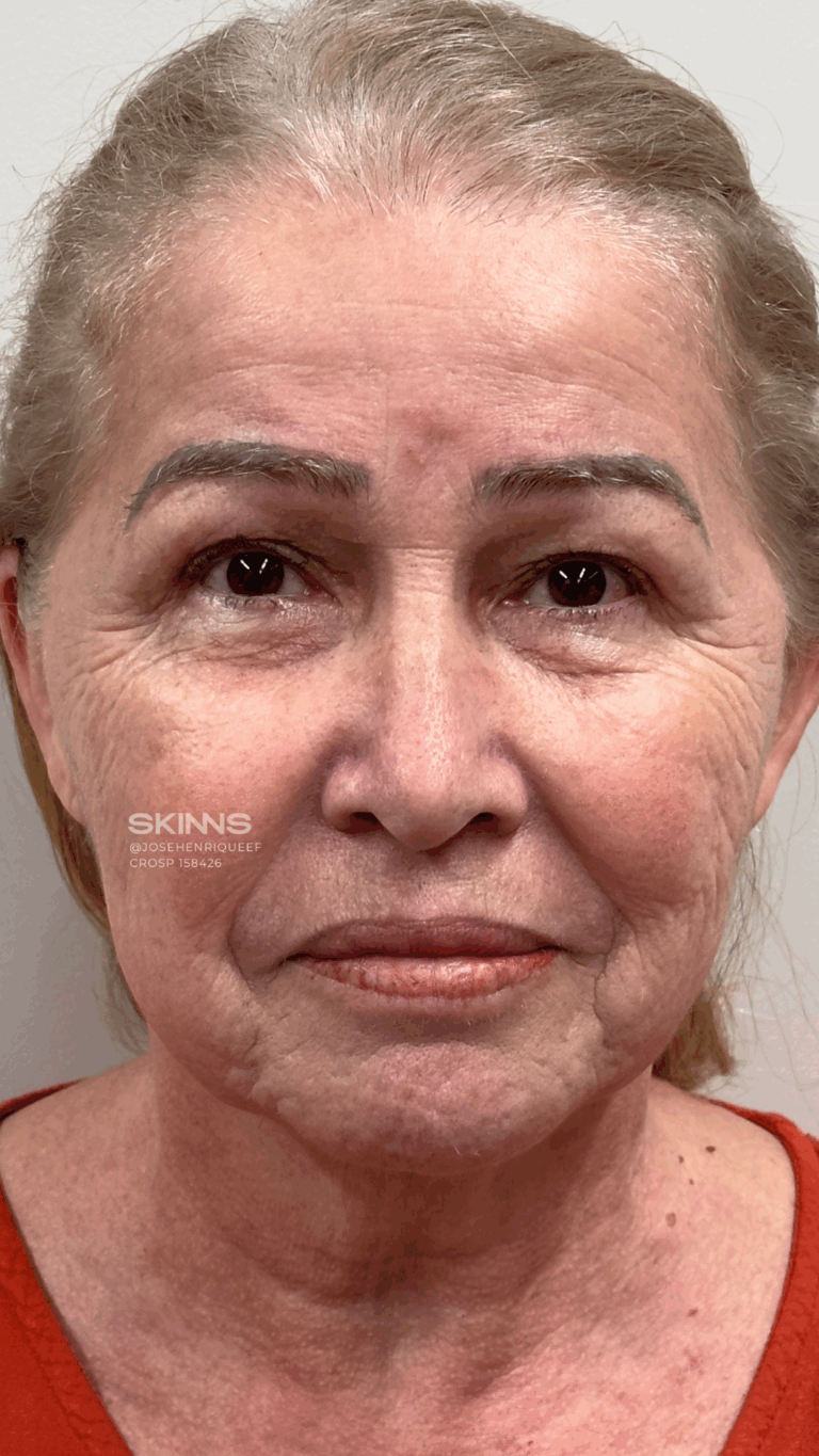 SKIMS Rejuvenescimento Resultados.zip - 3