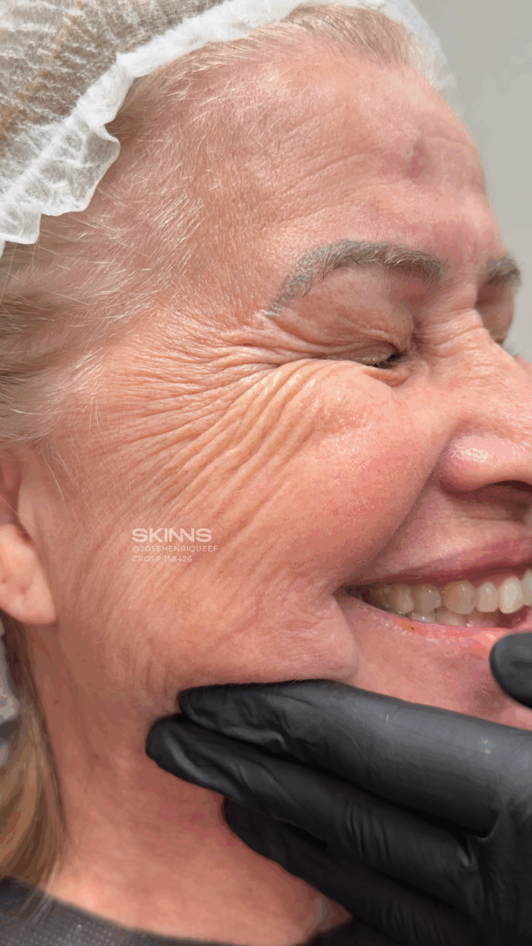 SKIMS Rejuvenescimento Resultados.zip - 7