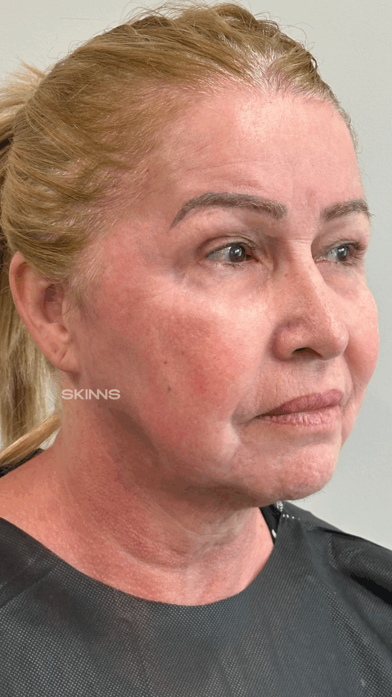 SKIMS Rejuvenescimento Resultados.zip - 9