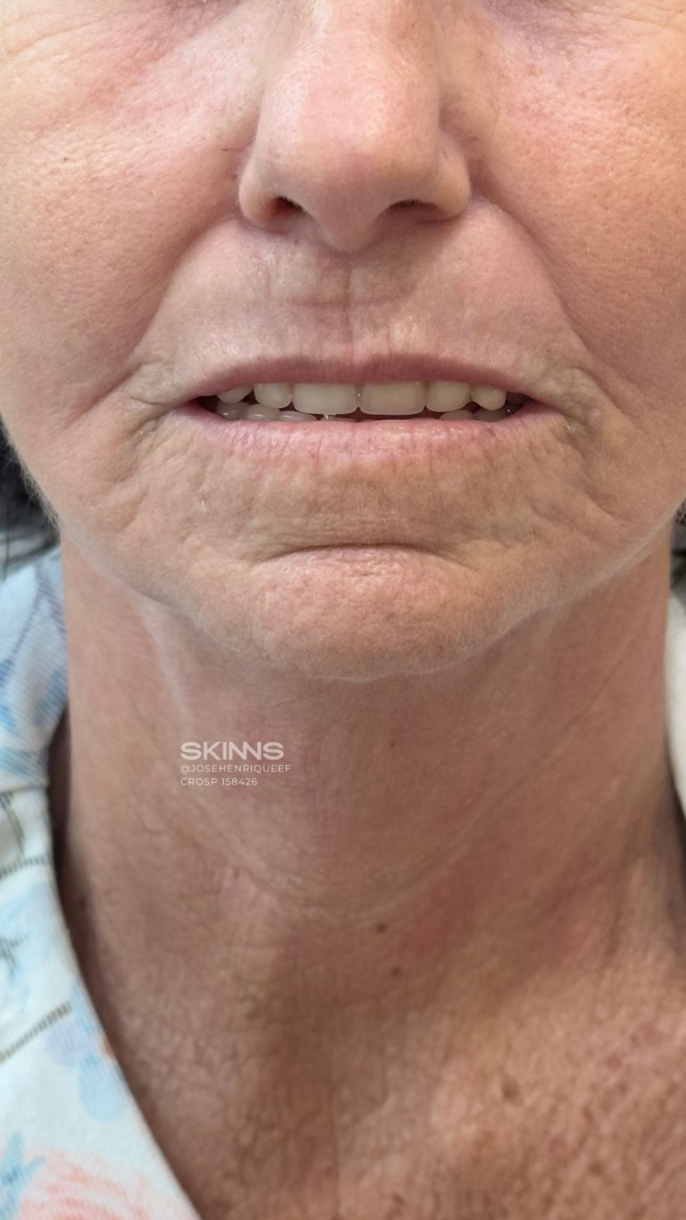 skins-rejuvenecimento-1837