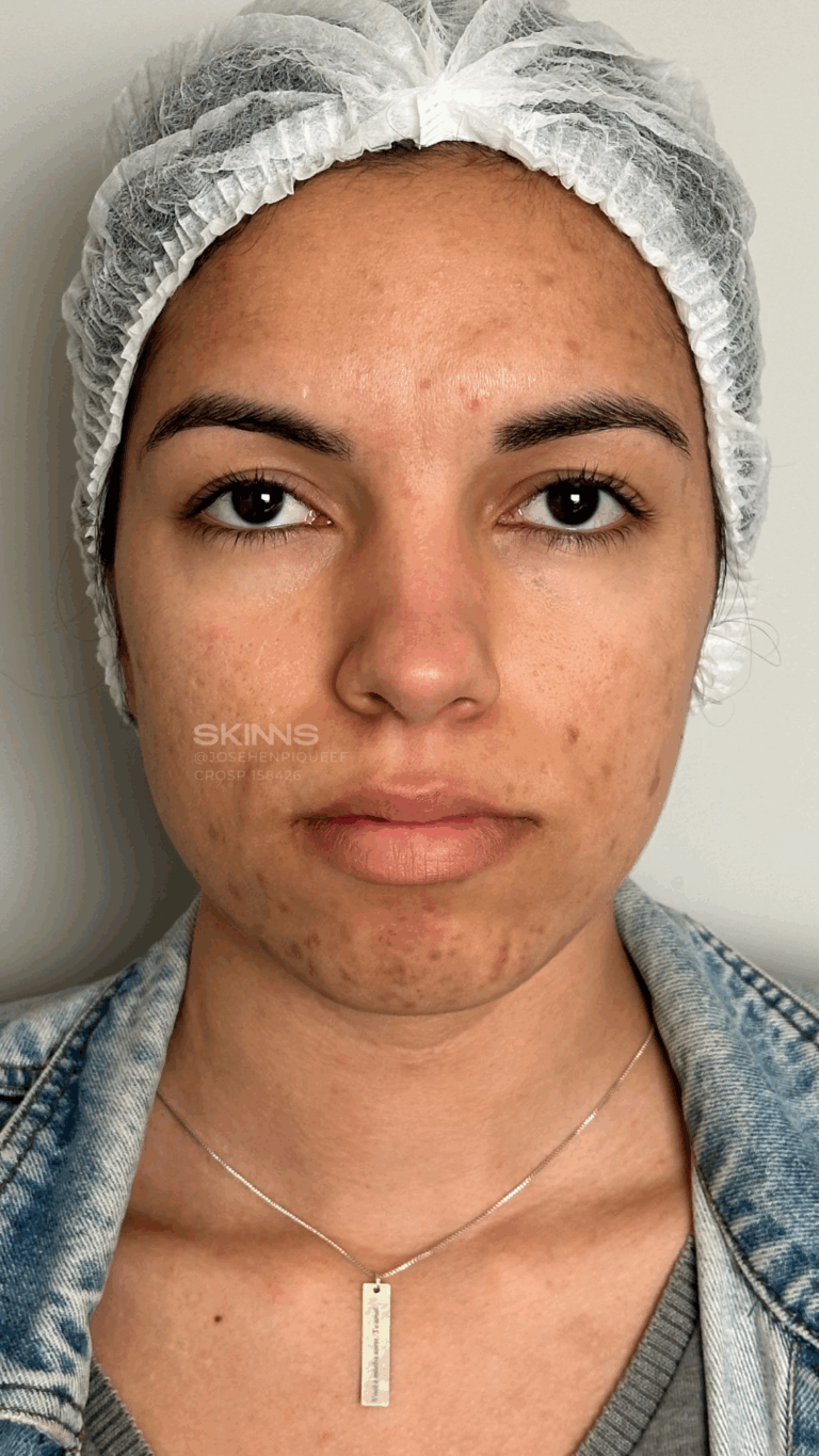 SKIMS MELANI Resultados.zip - 1