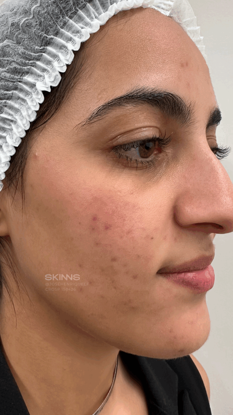 SKIMS MELANI Resultados.zip - 17