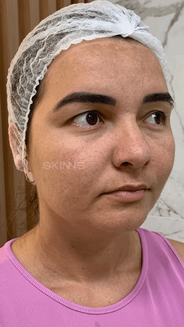 SKIMS MELANI Resultados.zip - 19