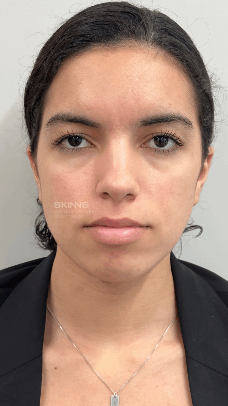 SKIMS MELANI Resultados.zip - 2