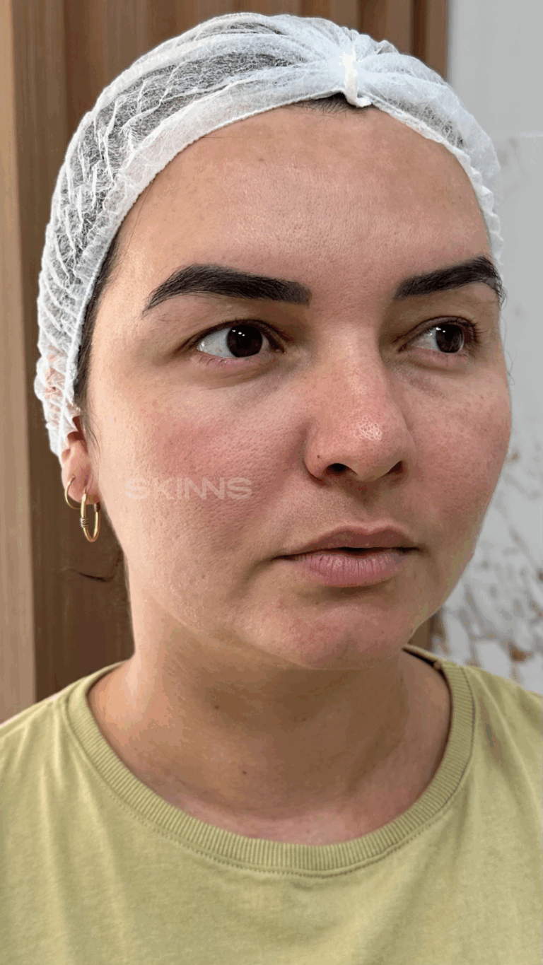 SKIMS MELANI Resultados.zip - 20