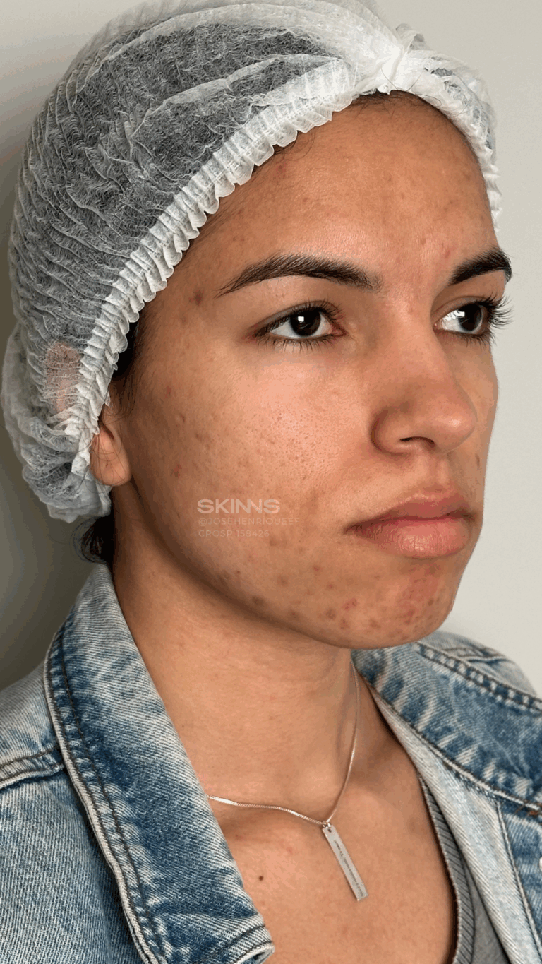 SKIMS MELANI Resultados.zip - 3