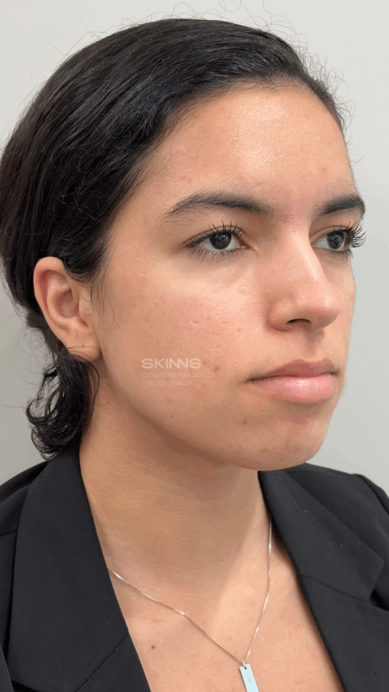 SKIMS MELANI Resultados.zip - 4