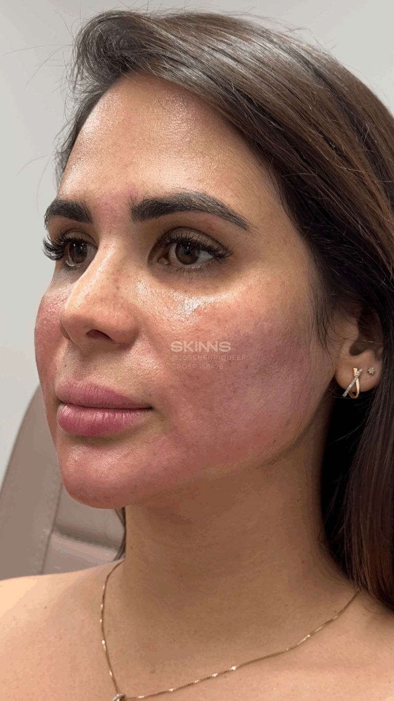 SKIMS MELANI Resultados.zip - 6