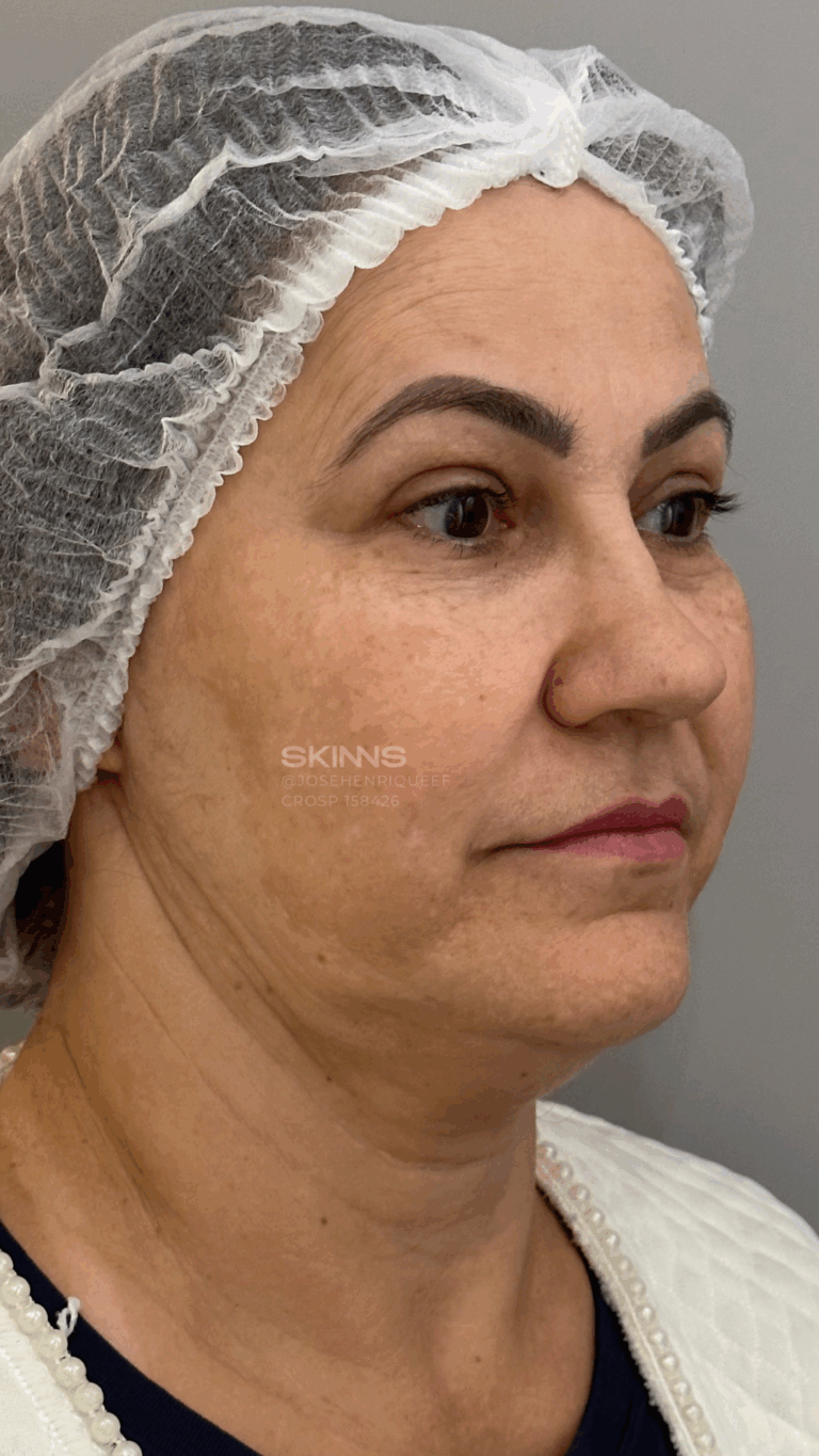 SKIMS MELANI Resultados.zip - 7