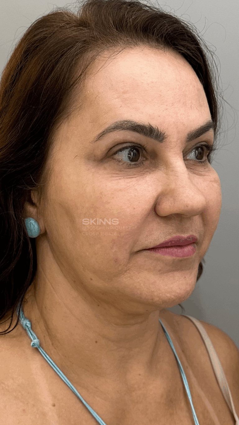 SKIMS MELANI Resultados.zip - 8